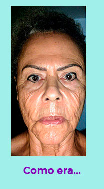 antes-12.jpg