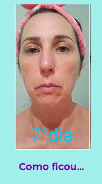 antes-depois-9.jpg