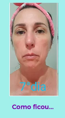 aluna10-new.webp