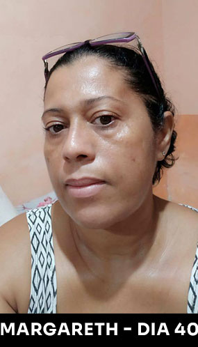 margareth-2