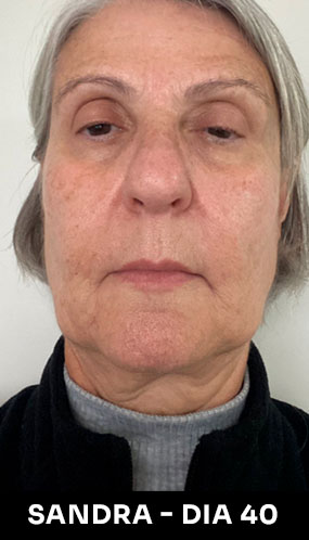 sandra-40